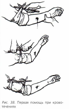 ������ ������ ��� ������������